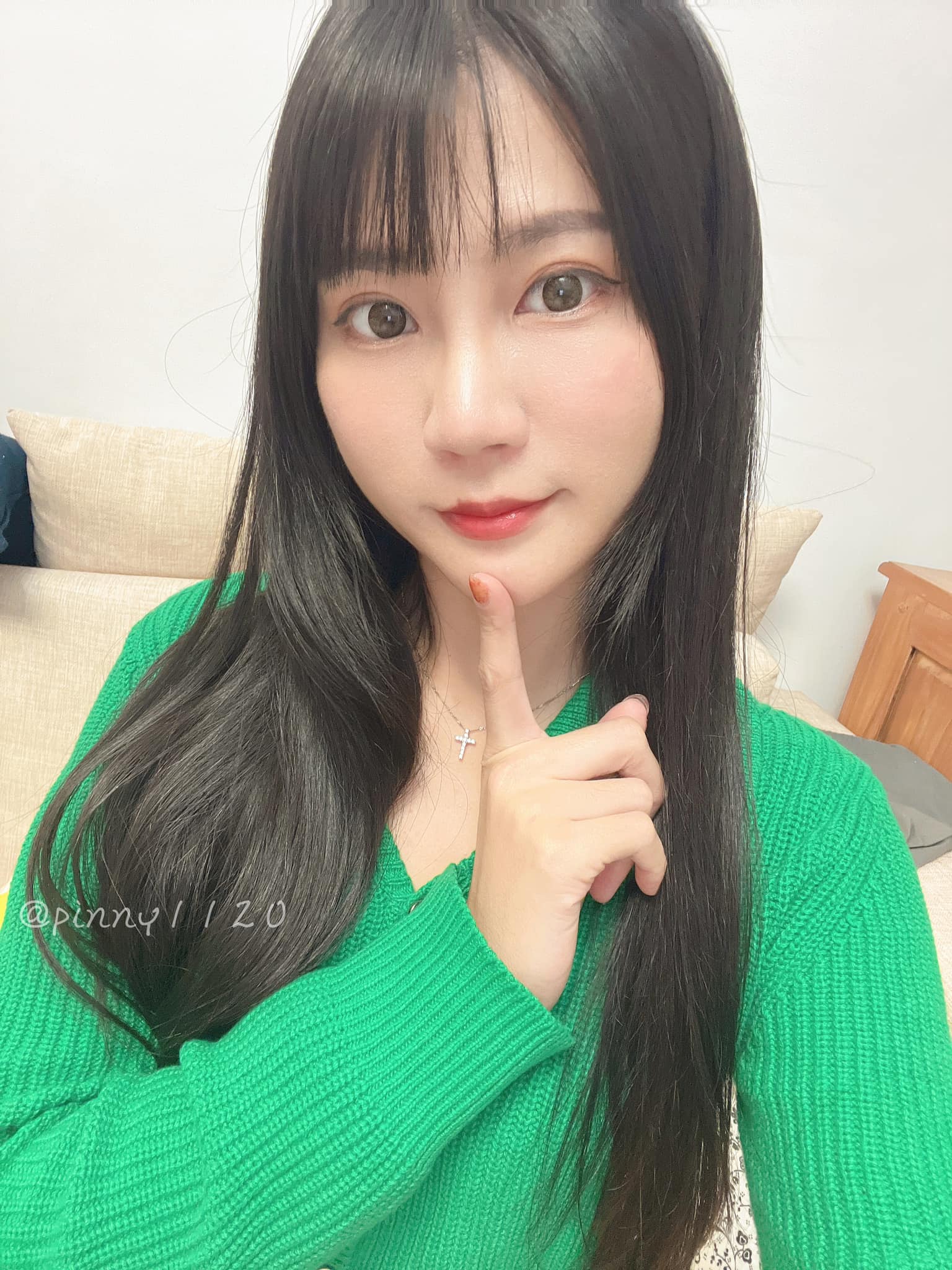 【玻尿酸】星和診所/板橋醫美-一點點調整看起來變美美噠更有精神?-品諭 Pinny