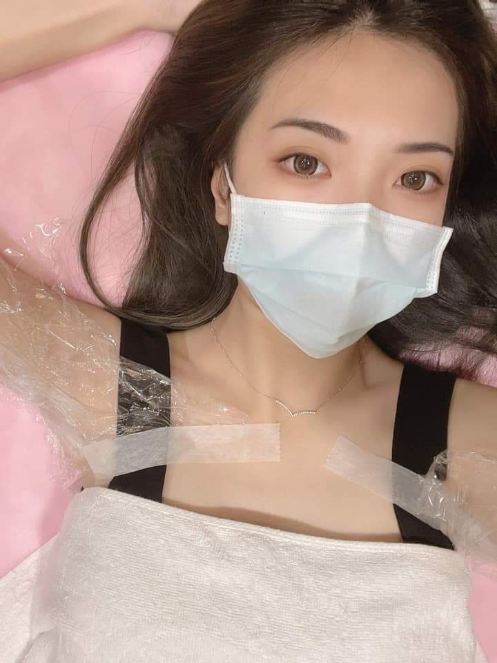 【雷射除毛】 炎炎夏日女孩們真的很需要雷射除毛～！！！-Kimmy 芃芃