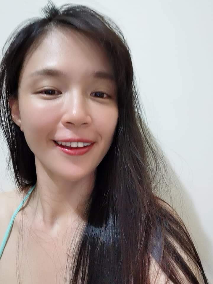 【晶亮瓷】 膠原蛋白增生的效果讓蘋果肌變得更澎潤，看起來氣色較好、膚質也變得更緊緻光滑！～-吳乙秦
