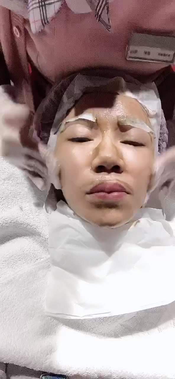 【杏仁酸煥膚】做完感覺毛孔都乾淨了！油膩厚重感都沒了~-布小丁
