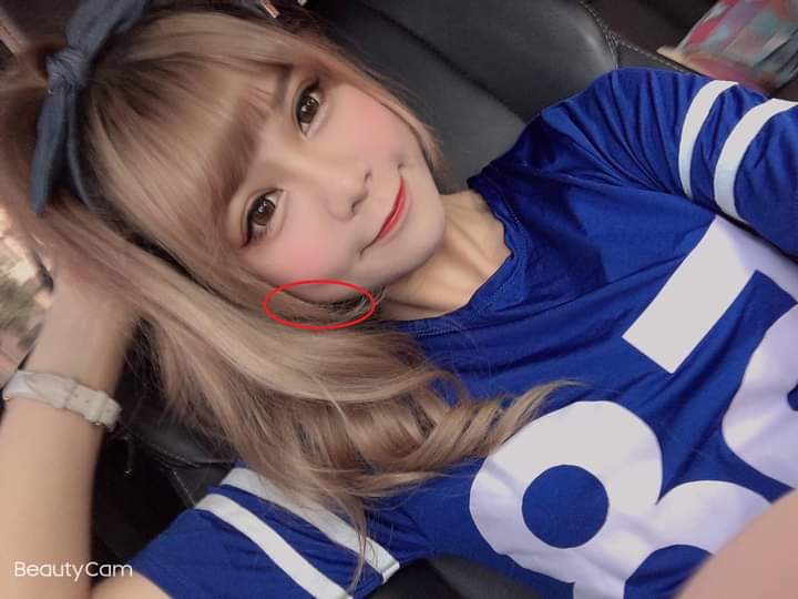 肉毒桿菌】前陣子跑去打了肉毒～ 想來個肉毒小臉 沒感覺不會痛！！！～-曾珮雯