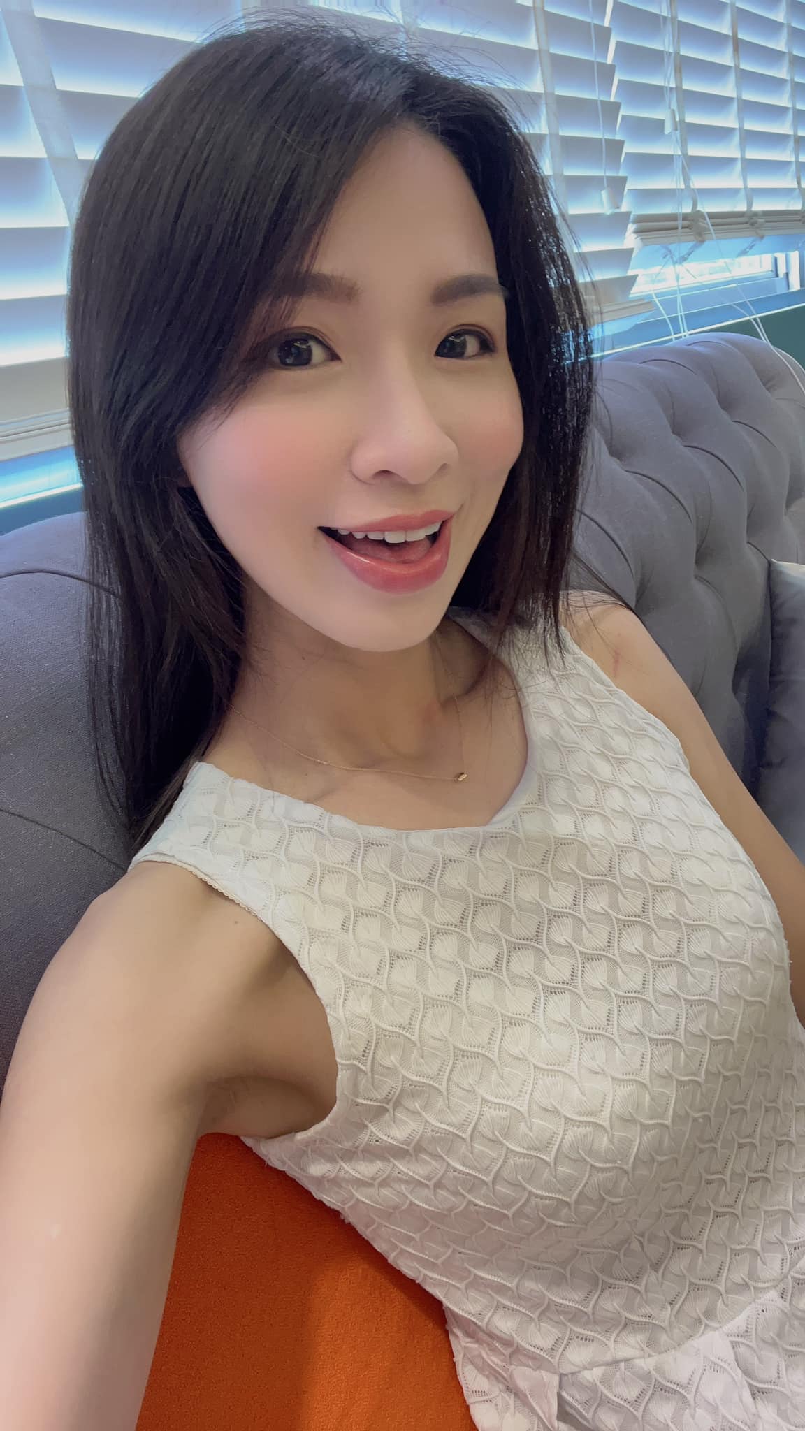 【皮秒雷射】星和診所/仁愛店_劉宜樺醫師-定期皮秒保養~推薦給大家-小燕子