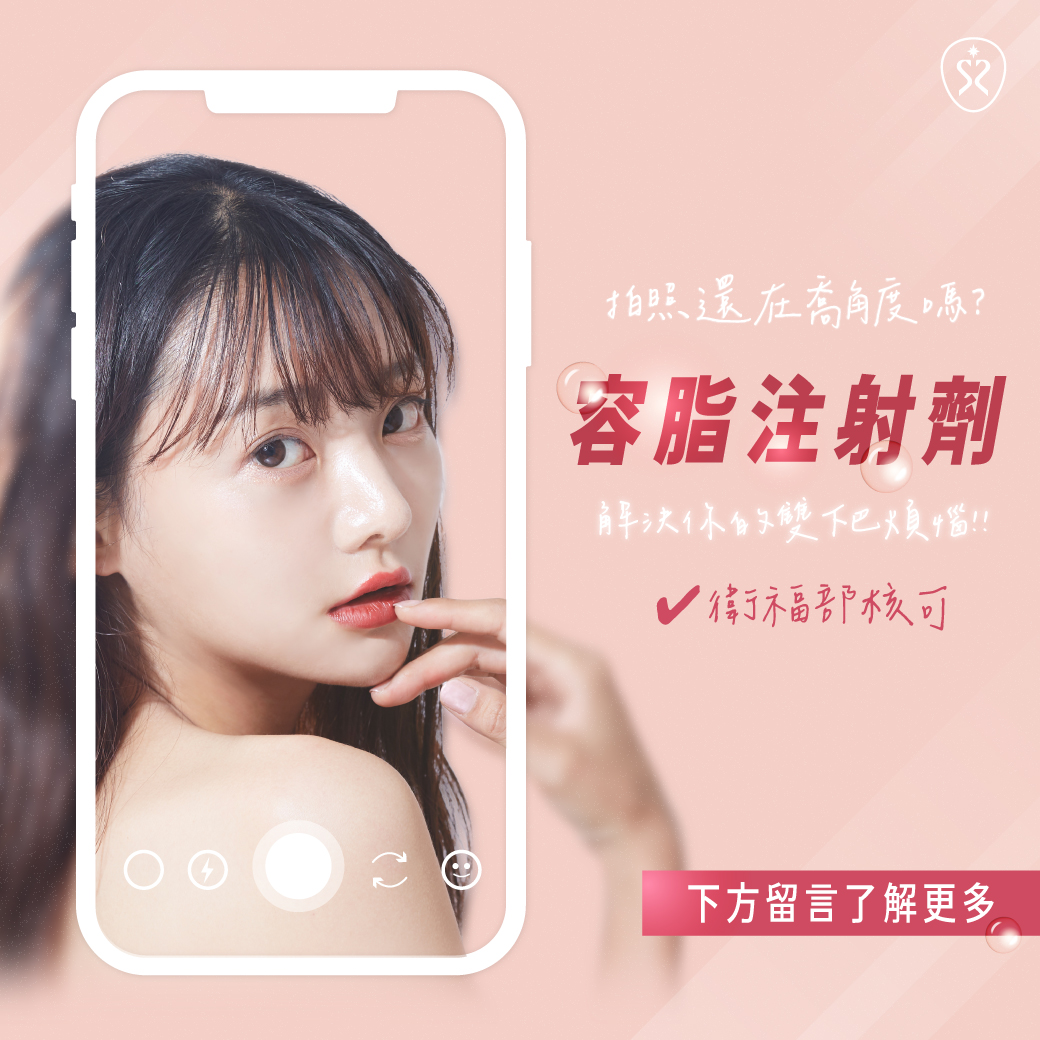 雙下巴