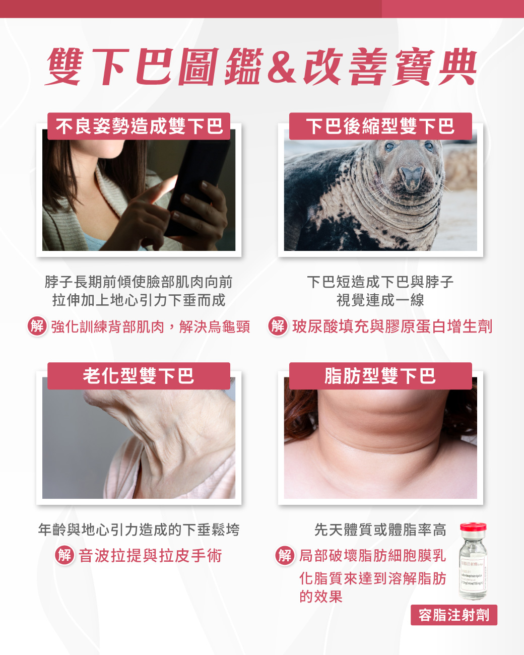 雙下巴