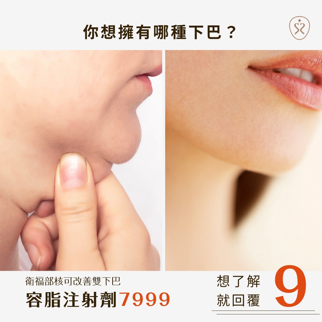 雙下巴