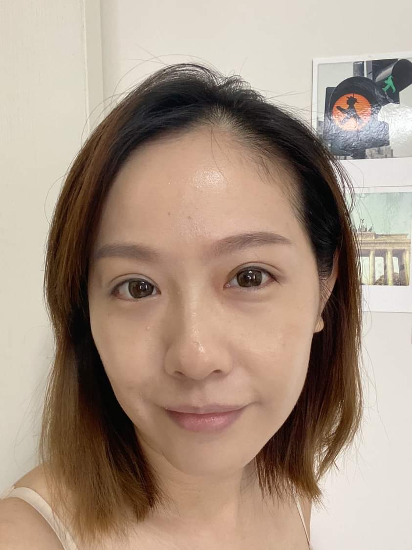 【杏仁酸煥膚】做完療程後臉上真的乾淨多了，最近上粉底也可以不必遮遮蓋蓋❤❤～！！！ ~-C'est Shelly