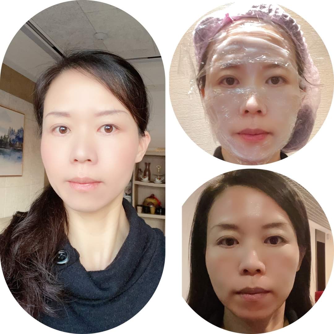  【皮秒雷射】星采整形外科診所/大安醫美-武洵白醫師-女人就是該多愛自己一點！-Cinya的私房烘焙課