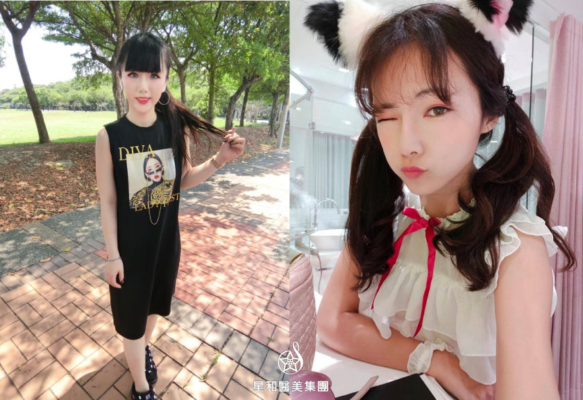 【活力滿點滴】星和診所/台中醫美-黑肉底也可以變亮白-涵茜、黎兒