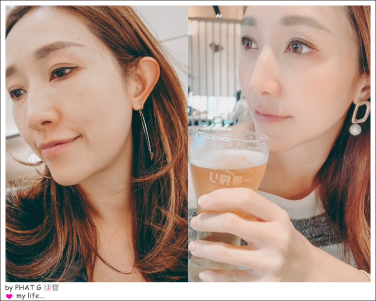 【極線音波拉提】星采整形外科診所(大安)-讓臉部輪廓更明顯的美國Ulthera極線音波拉提-恬寶 (上)
