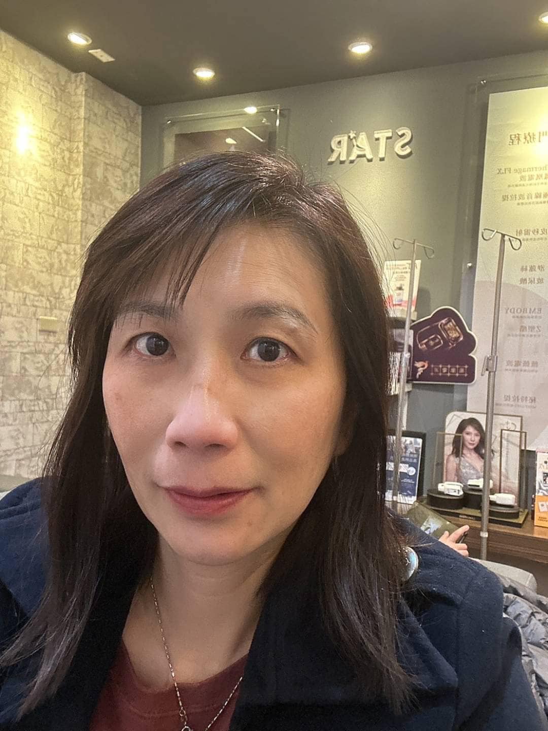 皮秒雷射
