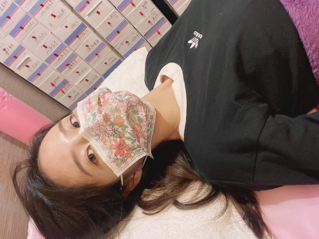 【雷射除毛】擺脫毛毛蟲，夏天繼續當美女！！！-元氣女孩 小慈 粉絲加油團