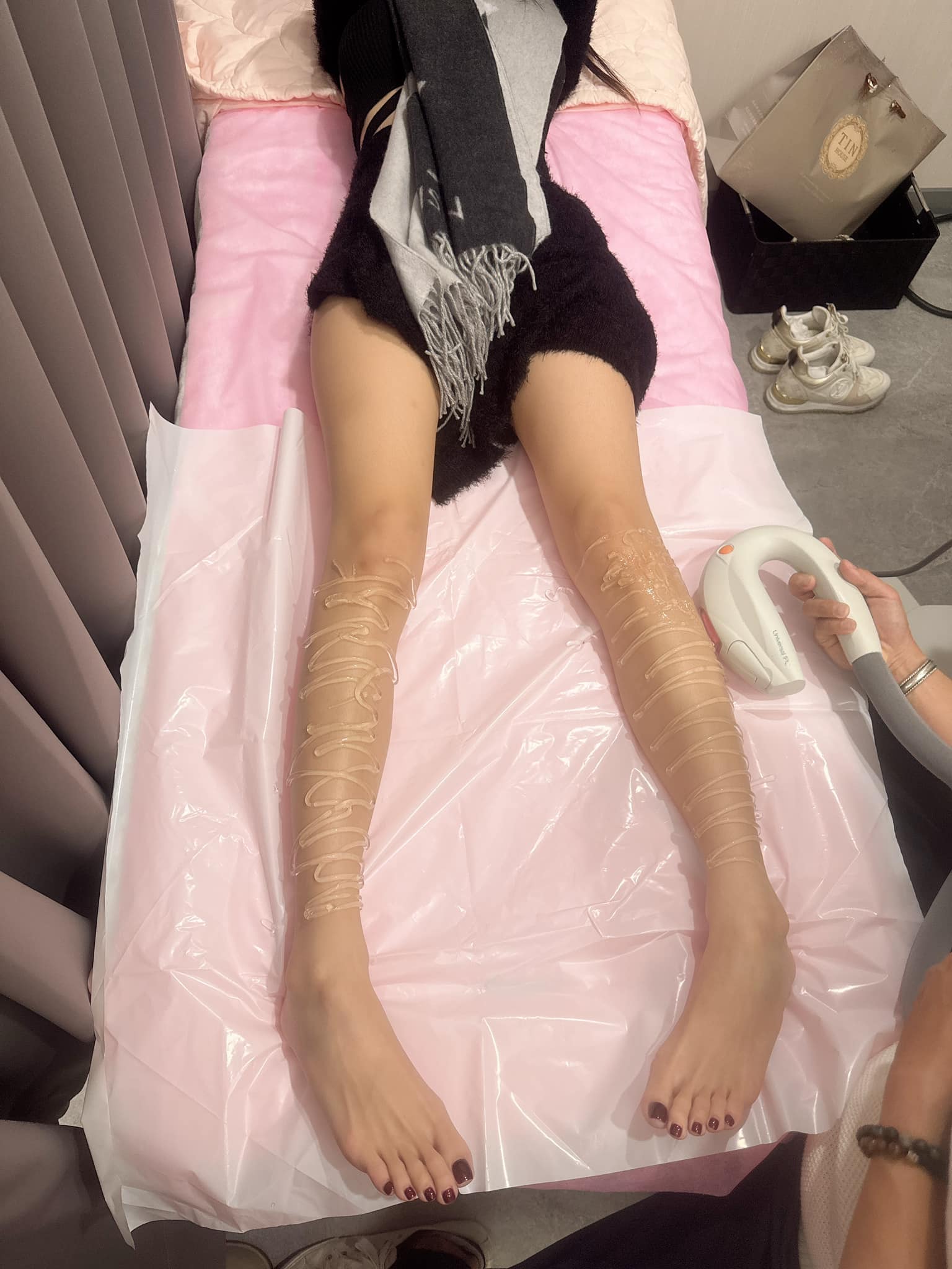 【雷射除毛】