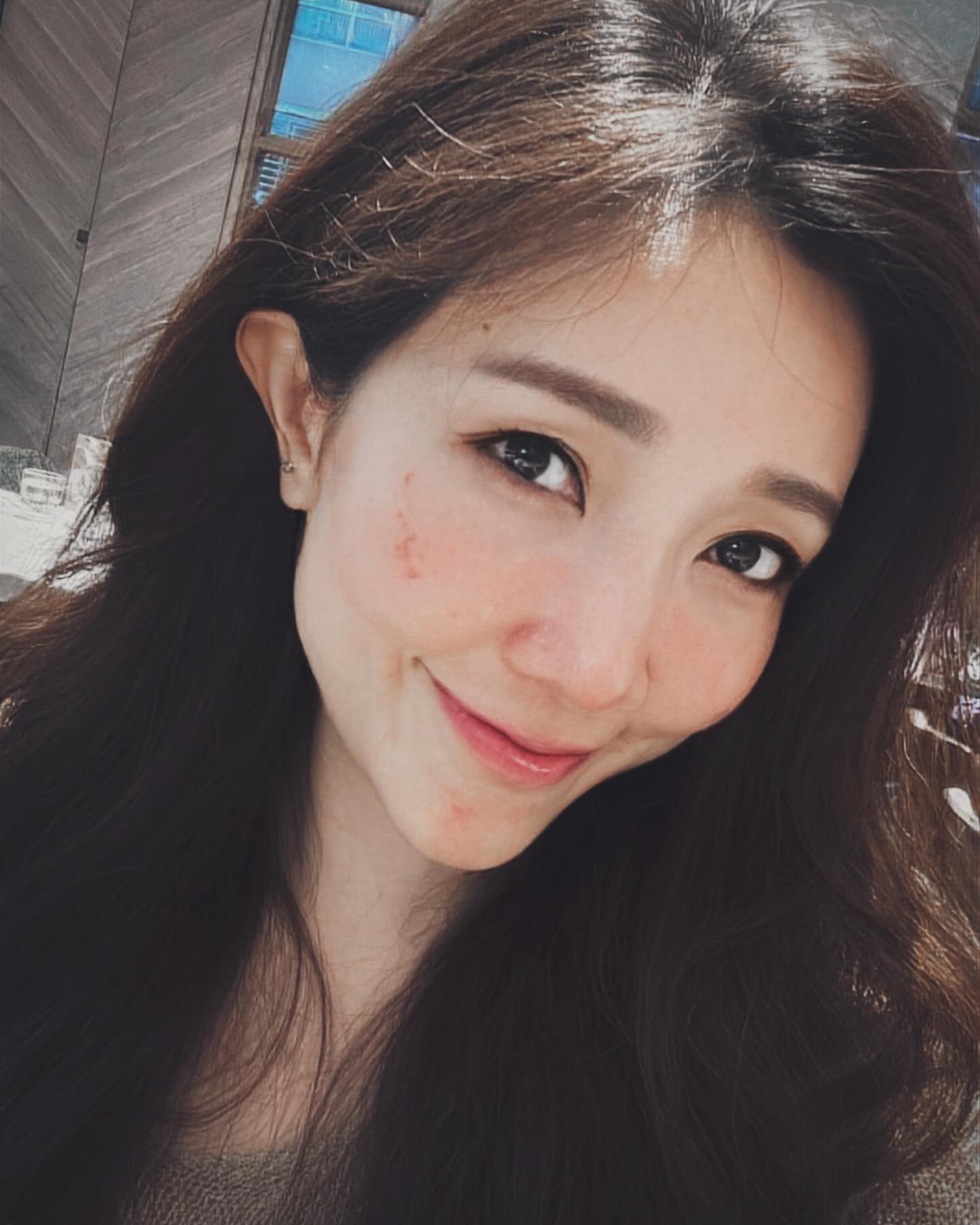 皮秒雷射