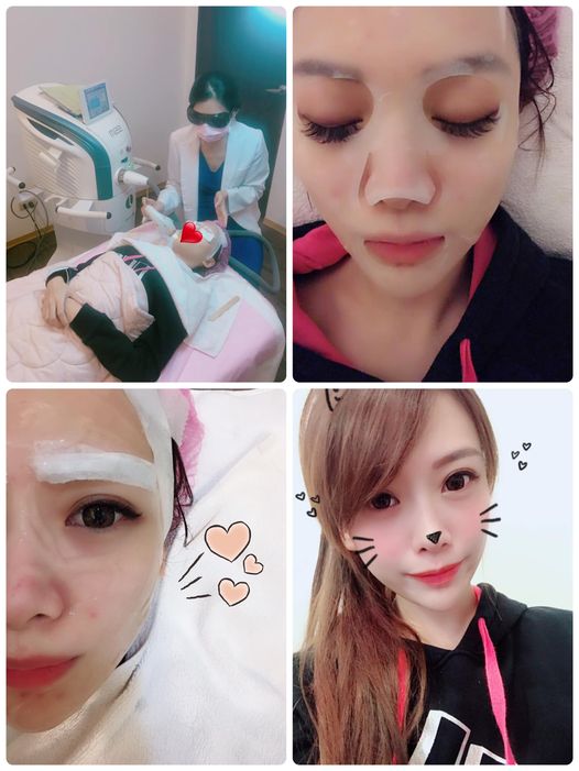 【彩衝光】最近換季過敏就算了，臉上痘痘也猖狂！