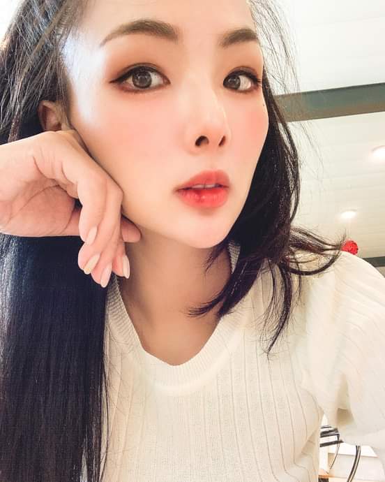 【玻尿酸】藉由玻尿酸注射，讓我有嘟嘟的嘴唇~ - Alison Yeh