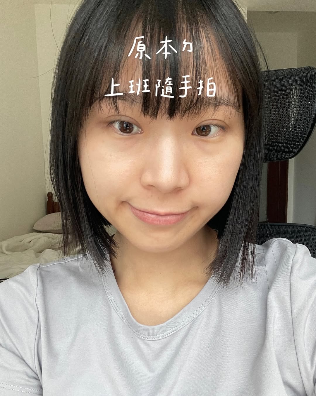 【水光注射(俗稱水光針)】