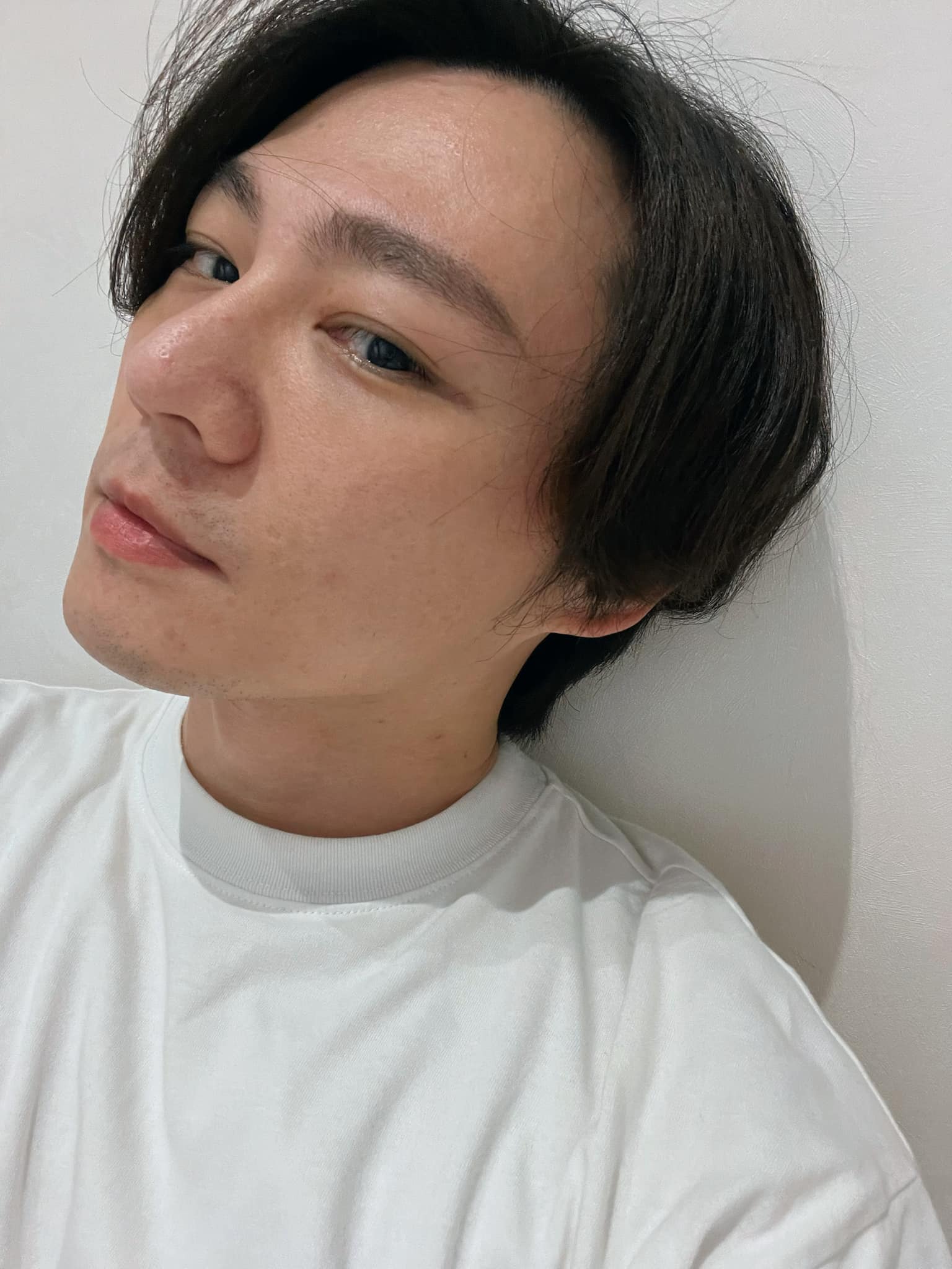 【杏仁酸煥膚】