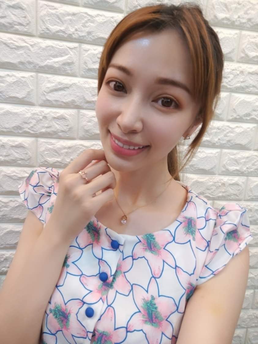【玻尿酸】平時就固定在星和保養，嘴角真的有微上揚的感覺~而且很自然喲 !!!~ -小瑾~Angela