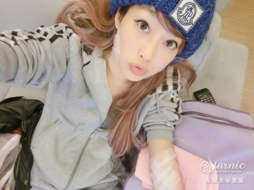 【瘦小臉注射】星和診所（新竹）陳明如醫師-追求完美無極限之我要當零死角女神~ (下)