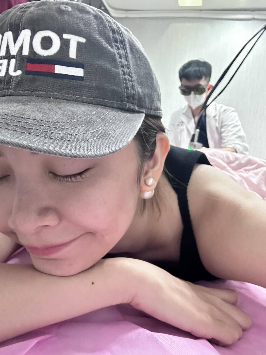 【雷射除毛】