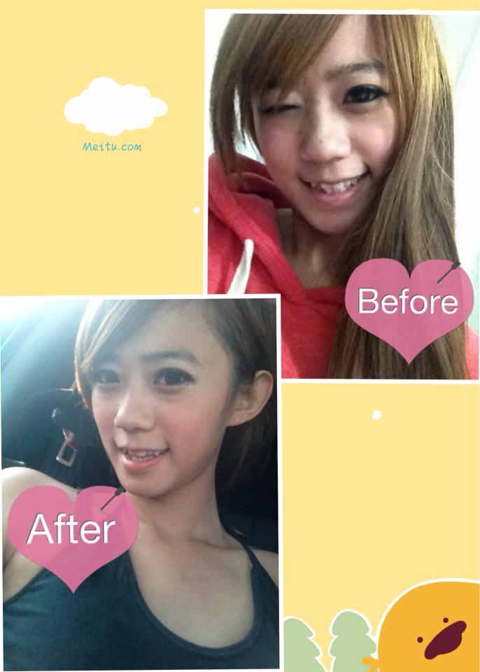 大家有發現我皮膚變比較亮嗎＞＜偷偷告訴大家〜 最近去星和醫美打了脈衝光！！ 效果好好＞＜好開熏唷！！ 好期待下一次的療程喔＞＜ - ✓經過夏天烈焰日曬☀️跑出的斑點 ✓或是長完痘痘後的惱人痘疤? ?可以透過彩衝光來治療，不過每個人的疤痕種類、斑點深度都不同， 一定要先由專業醫生進行諮詢，才能找出最適合自己的治療方式， 打完之後沒化妝臉也啵亮??上妝服服貼貼的心情就是好?  彩衝光 ✓肌膚暗沉 ✓雀斑、曬斑 ✓臉部泛紅血絲 ?無恢復期 ?可立即上妝