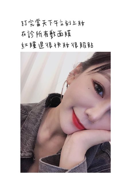 【皮秒雷射】開始會很期待自己卸妝後的膚質