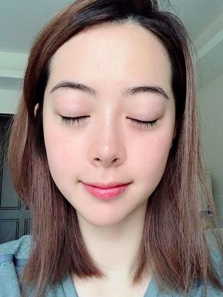 【皮秒雷射】現在皮膚超滑！效果認真有意外到