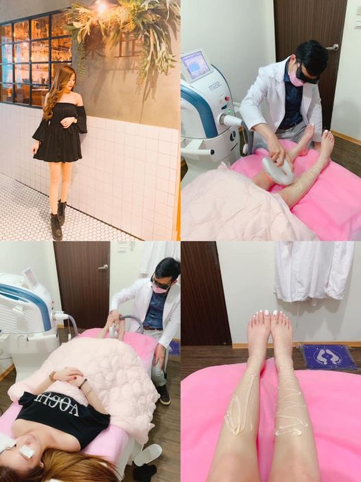 【雷射除毛】真心推薦需要常常刮手毛腳毛的女孩~要去除一下?
