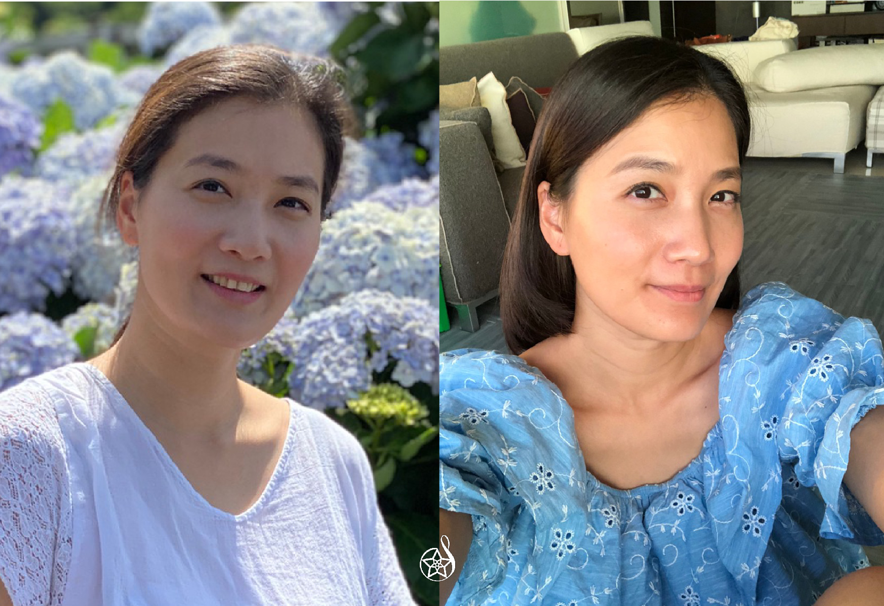 【極線音波拉提(優珊納超音波治療儀)】星采整形外科診所(大安)-留住青春的拉提初體驗-李培禎 (上)