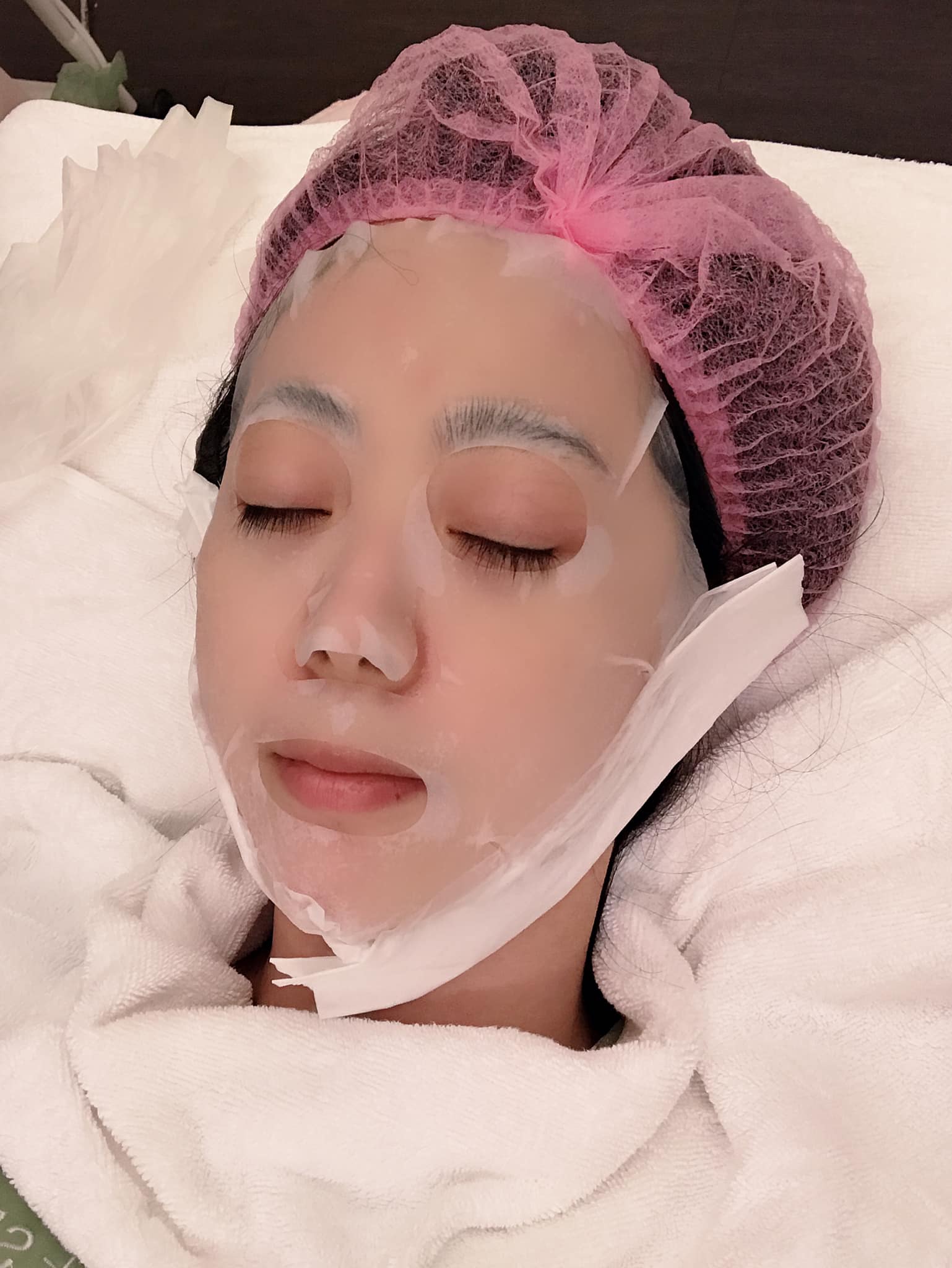 【杏仁酸】星和診所/台南醫美-做杏仁酸定期清一清討厭的內包粉刺?️-陳子沐