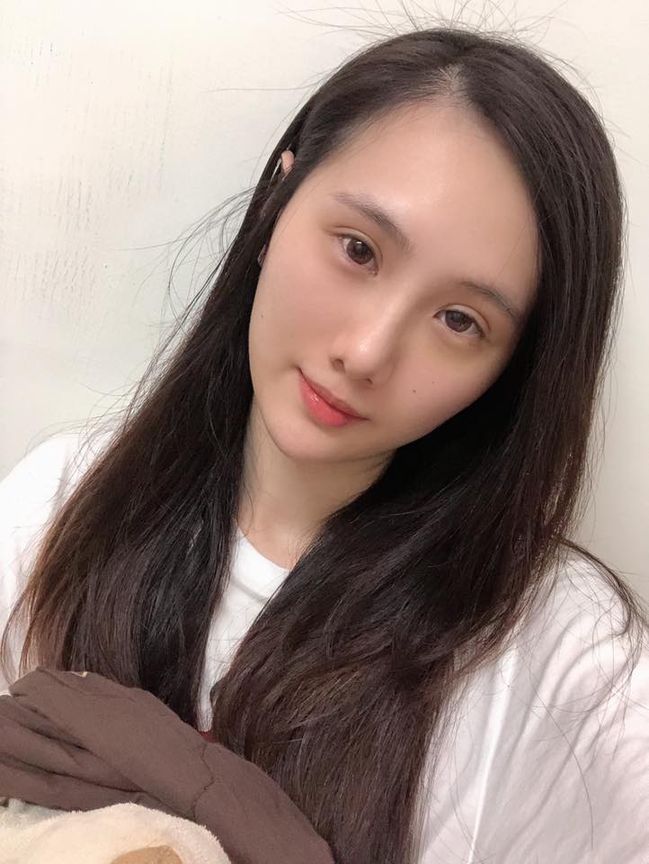 【杏仁酸】星采整形外科診所/大安醫美-而且做完杏仁酸換膚療程後，膚色有更透亮喔！-IRIS HAN ．佳陵