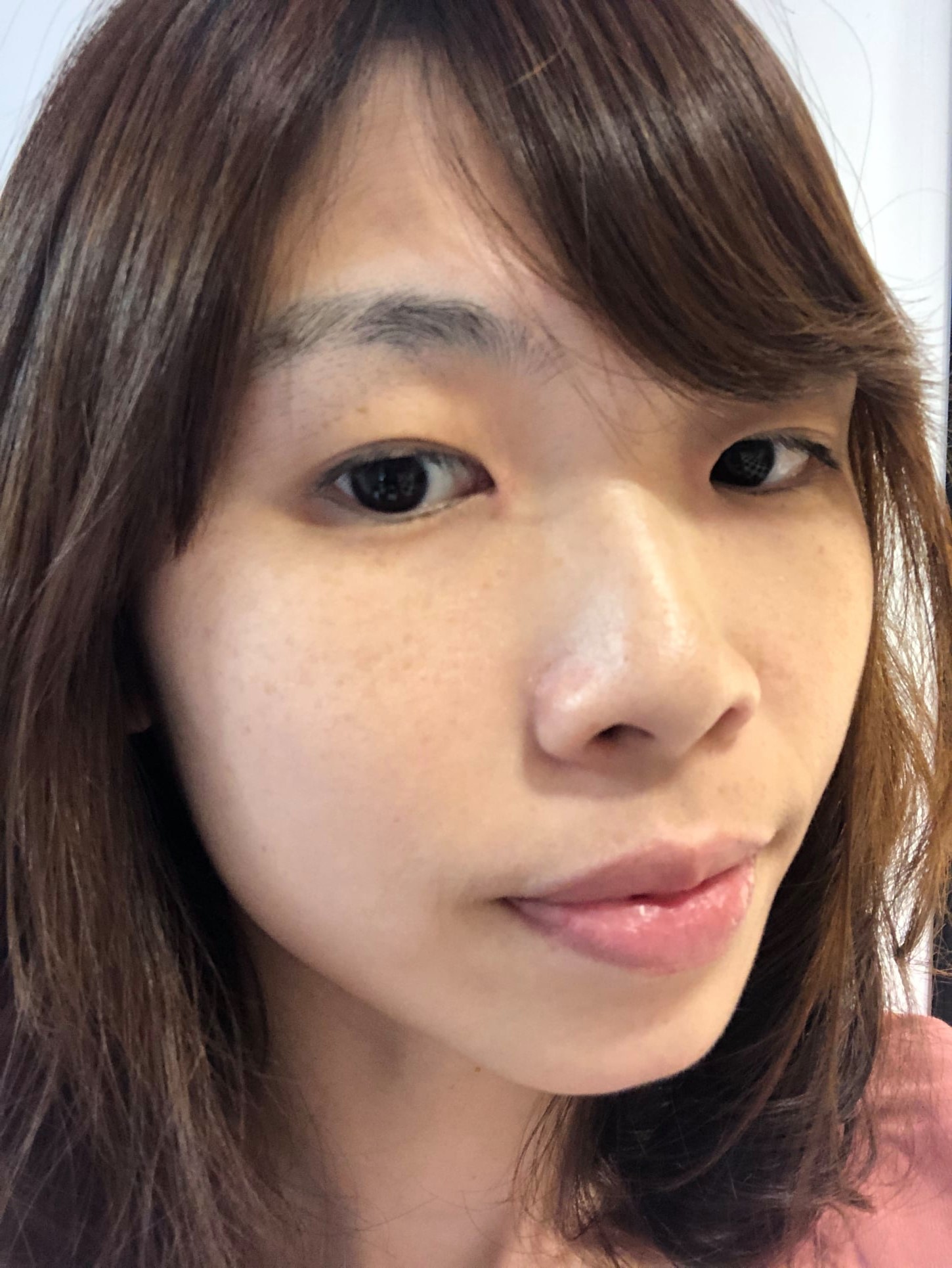 【皮秒雷射】星采整形外科診所(大安)-與臉部斑點的終極對決_Fan Fan 美好生活