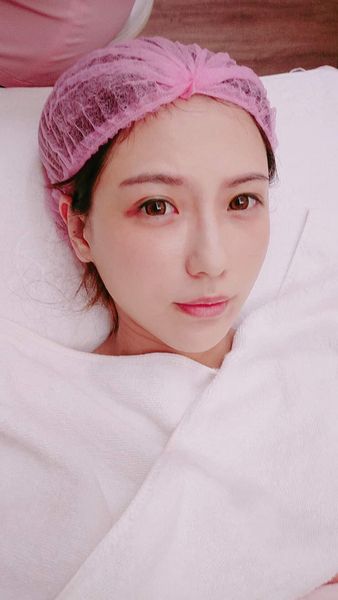 維納斯脈衝光