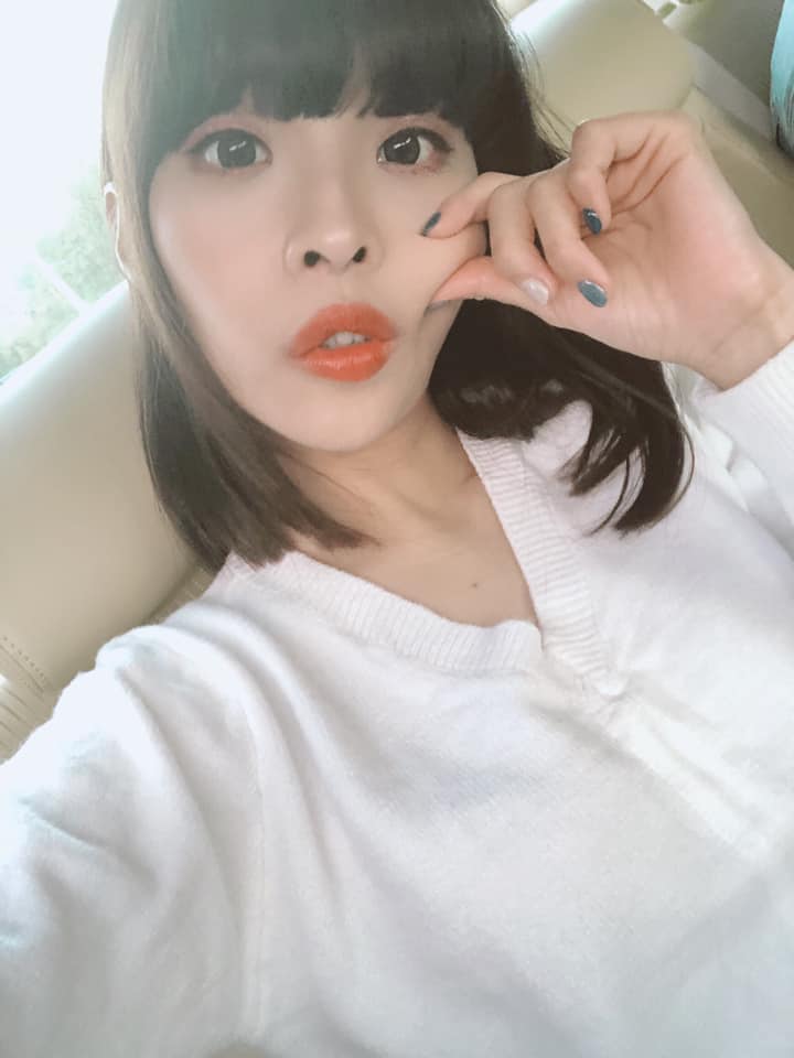 【杏仁酸】星和診所/台南醫美-日本妹妹以為我跟他們差不多歲?-Vivi(吳筱葳)