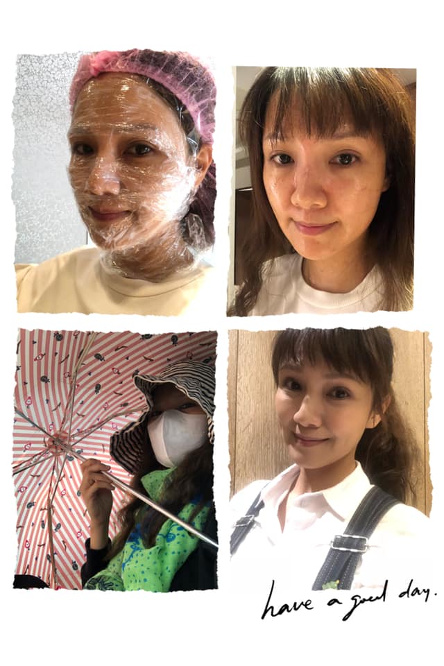 【皮秒雷射】星和診所-台中市-趁年前休息來打一下皮秒-陳嘉君