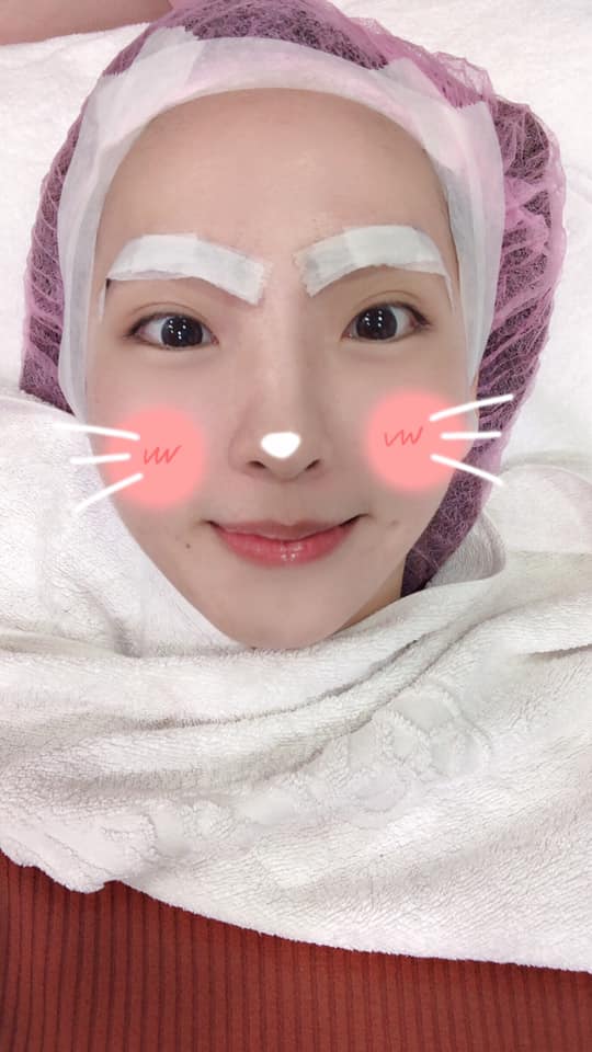 【彩衝光】星和診所/台北醫美-完全不會痛 好感動?-佳蕙的生活日記