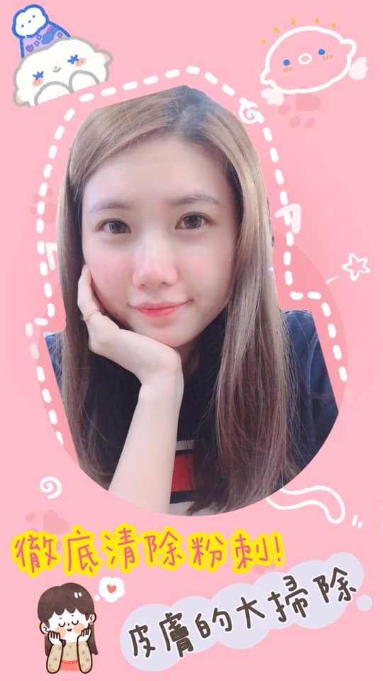   【杏仁酸】星和診所/台南醫美♥清了超多粉刺出來✨ -曉雅