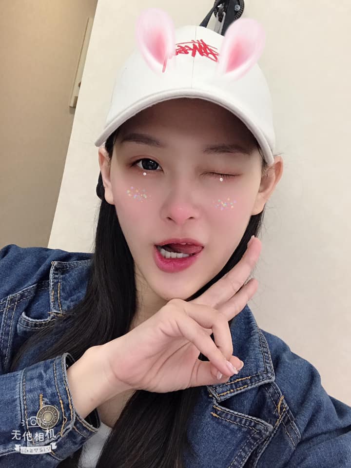  【杏仁酸】星和診所/台南醫美♥快一起變美美！? -搞怪小公主-安安