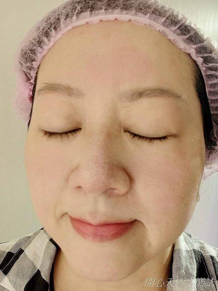 【雷射除毛】 最近毛孔大到很礙眼，這個月