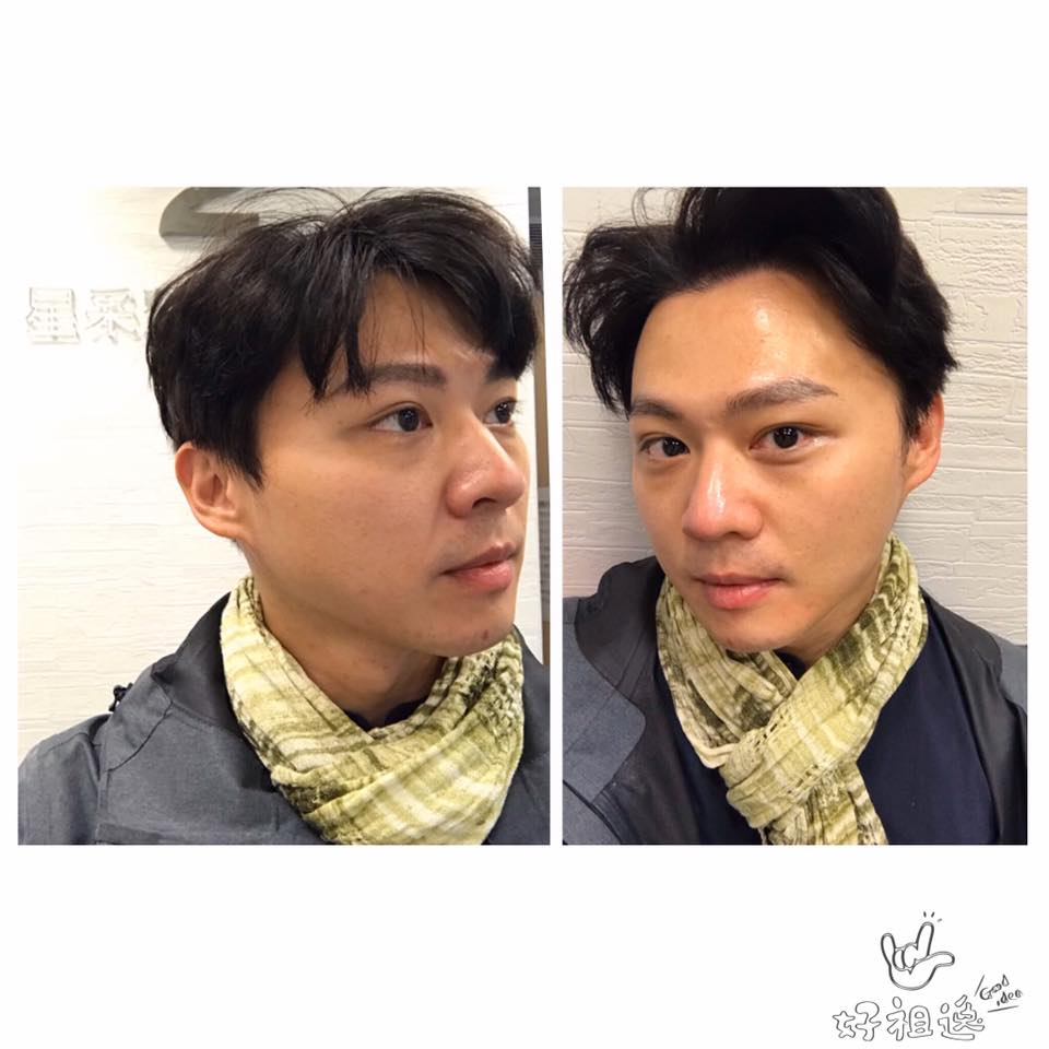  【杏仁酸】星和診所/大安醫美♥做完臉之後，就是透亮～～ -佘祖逸TzuYi SHE