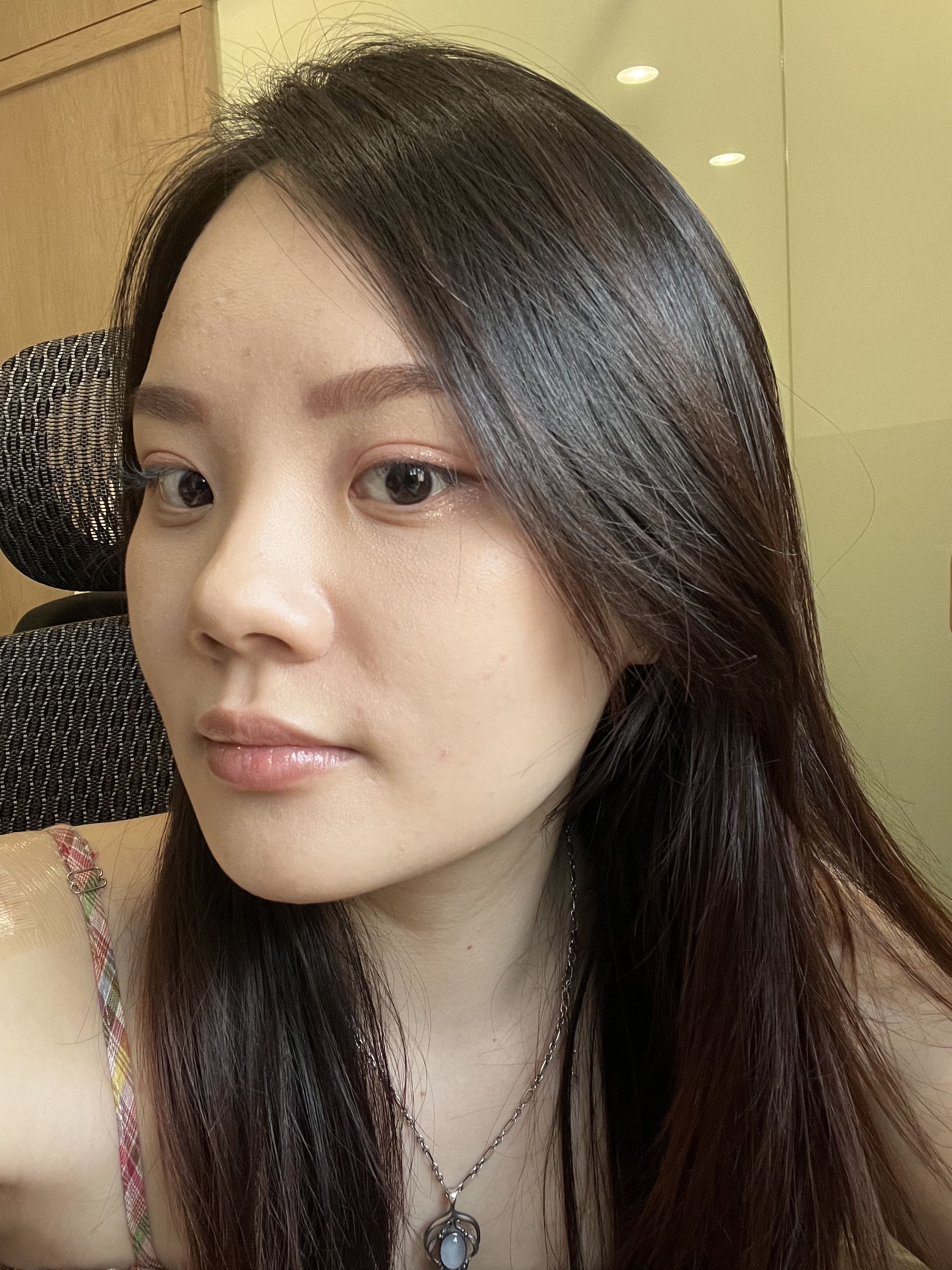 【修秘水光】星和診所(台中)-吳詩韻醫師-肌膚變得水潤、毛孔越來越細小,油光也得到控制,是一筆很值得的投資-睿玲