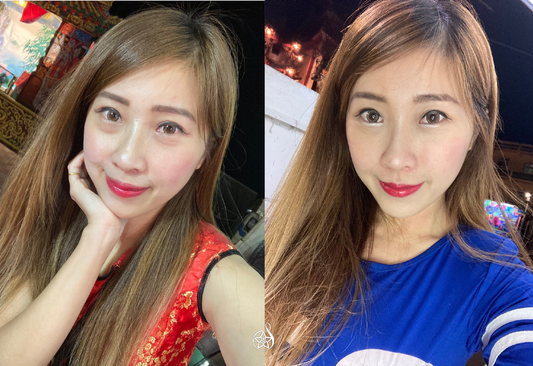 【玻尿酸蘋果肌】星和診所/高雄醫美-吳旻修醫師-凹陷掰掰！改善我疲憊又憔悴的眼神(上)-HUHU