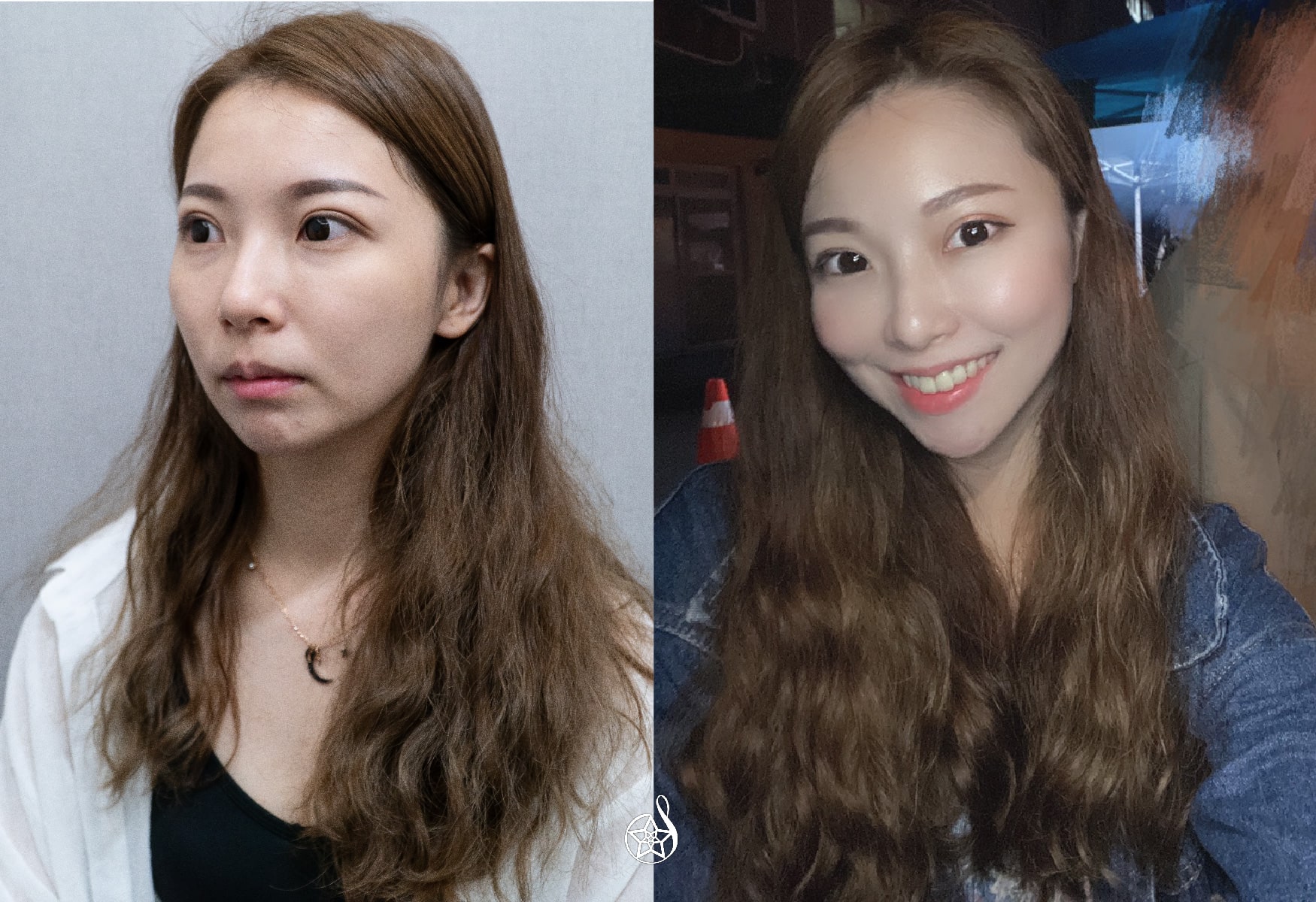 【女神動態玻尿酸】古亭星和診所-王善民醫師-提升氣色，讓顏值加分的秘密(下)-Rita