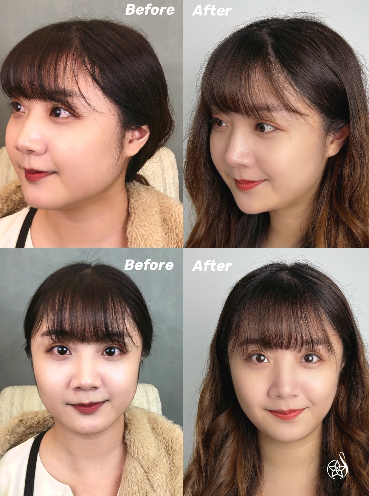 【瘦小臉注射】星和診所/台南醫美-周顥洋醫師-新年新嘗試，微整初體驗-DOCO妲可 (中)