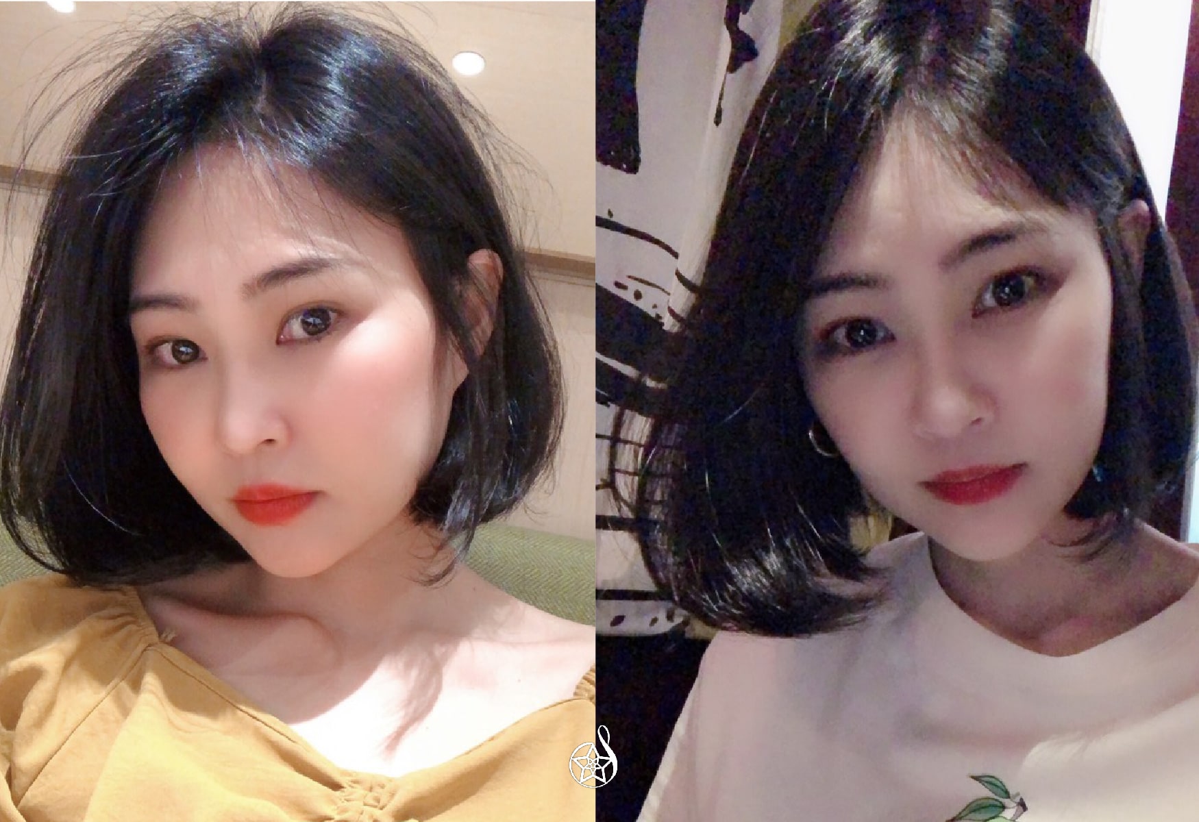 【玻尿酸豐額】星和診所（新竹）-黃伊寧醫師-一點點改變，讓自信大加分(下)-Celine