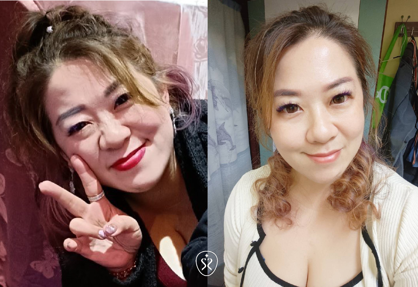 【優美施玻尿酸】