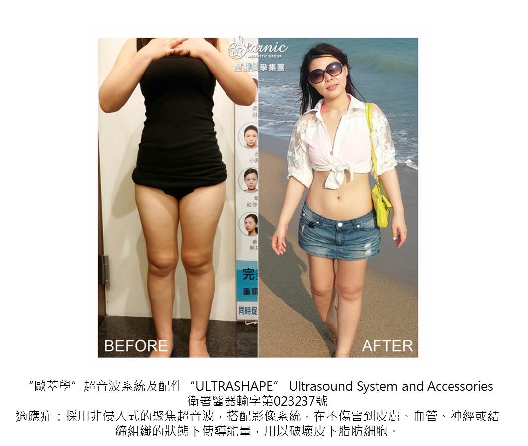 【歐萃學超音波系統（標靶震波）
