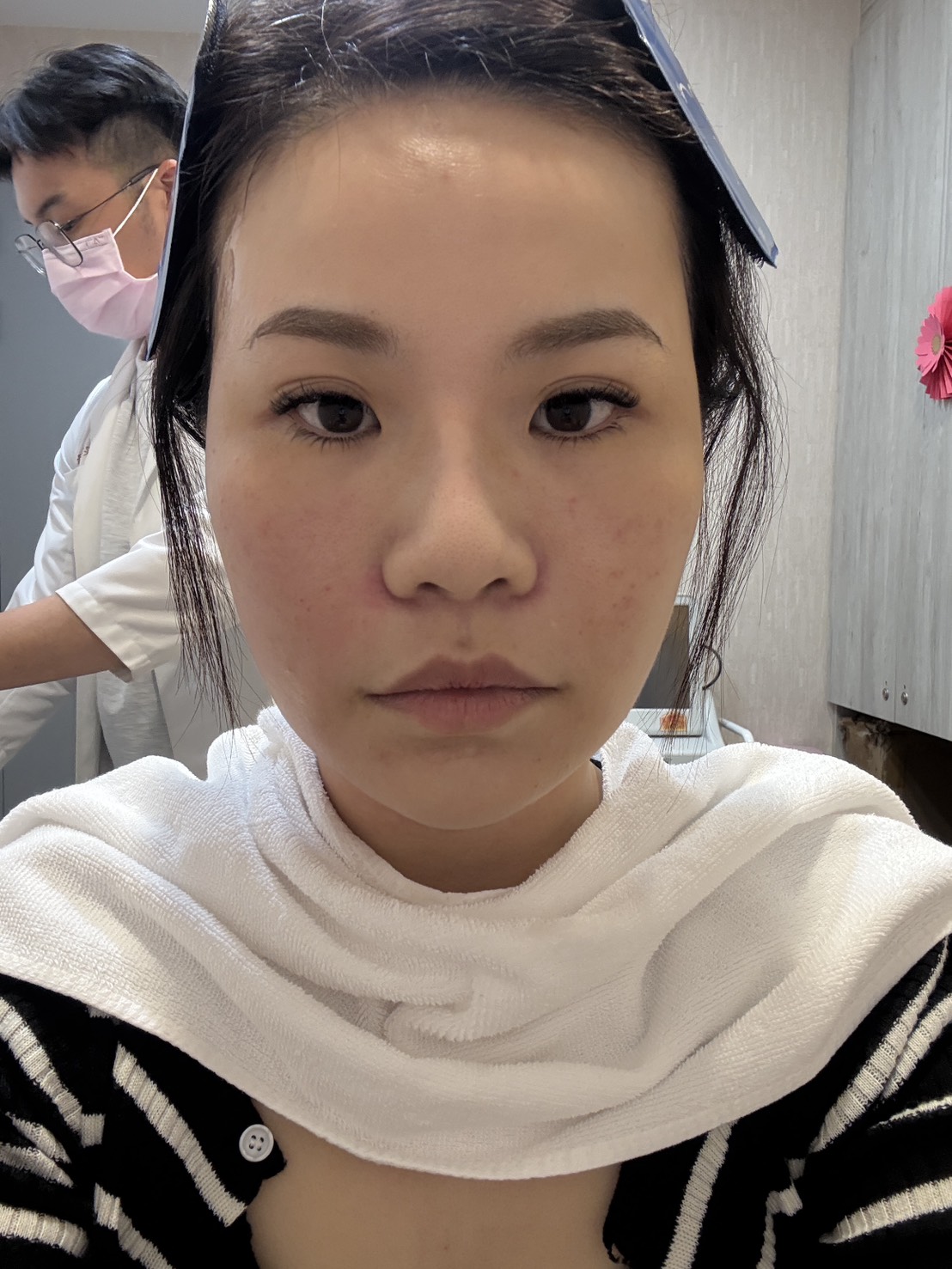【修秘水光電波】板橋星和診所-黃千乘醫師-皮膚非常明顯很緊實、毛孔及細紋也比較縮小及淡化，化妝時特別有感-Cassie