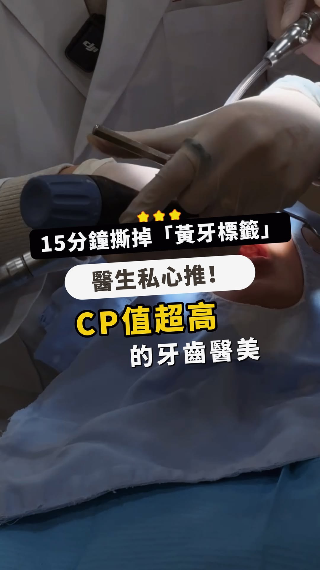 【噴砂美白】星采牙醫診所-林子盟醫師-開箱噴砂美白！原來我的牙齒本來沒有那麼黃