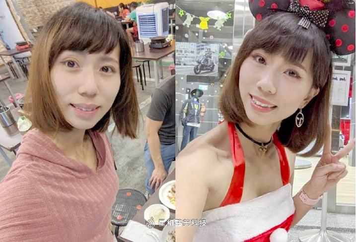 玻尿酸